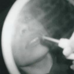 Woman Of Faces (Demo)